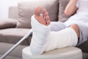 broken foot compensation