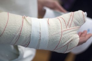 Broken hand compensation 