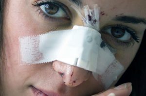A woman with multiple bandages and cuts on her nose