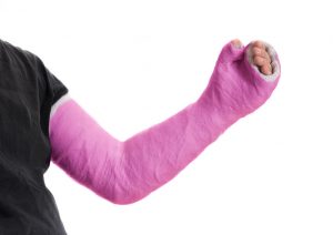 Broken thumb compensation