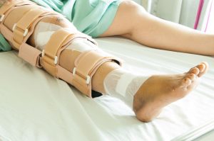 Buckle fracture compensation 