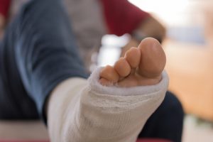 Broken foot at work claims guide 