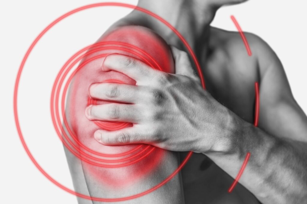 How To Claim For A Rotator Cuff Injury At Work