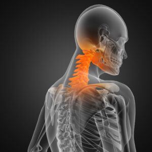 serious neck injury claim