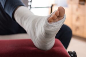 Colleague Ran Over Your Foot At Work