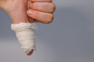 broken finger compensation claims