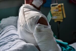 A patient in hospital with lots of bandages.