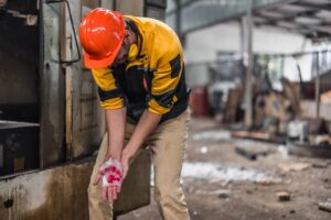 WORKER IN INDUSTRIAL SETTING SUFFERING WORPLACE CRUSH INJURY TO HIS HAND