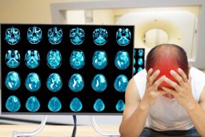 A man holding his red head in pain with a bunch of brain scan images behind him. 