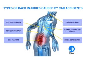 An anatomical illustration of a human torso highlighting the spine, with labels pointing to common back injuries caused by car accidents. These injuries include Soft Tissue Damage, Nerves in the Back, Disc Fracture, A Whiplash Injury, Strains, Sprains and Bruises, and Spinal Cord Injuries. The UK Law logo is in the bottom right corner.