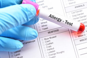 A test tube contains blood to carry out a blood test.