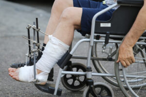 A man with a broken leg uses a wheelchair outside.
